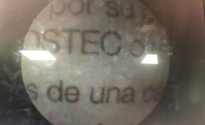 椎间孔镜治疗的临床研究及joimax椎间孔镜维修案例