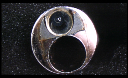 经皮肾镜碎石取石术的教学模块及SOPRO 165800011经皮肾镜的维修案例分析